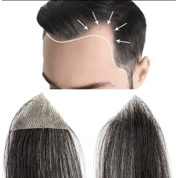 Mesa Adeziva pentru Alopecie